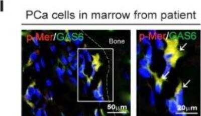 Immunocytochemistry/ Immunofluorescence: Mer [p Tyr754, p Tyr749, p Tyr753] Antibody [NB300-690]